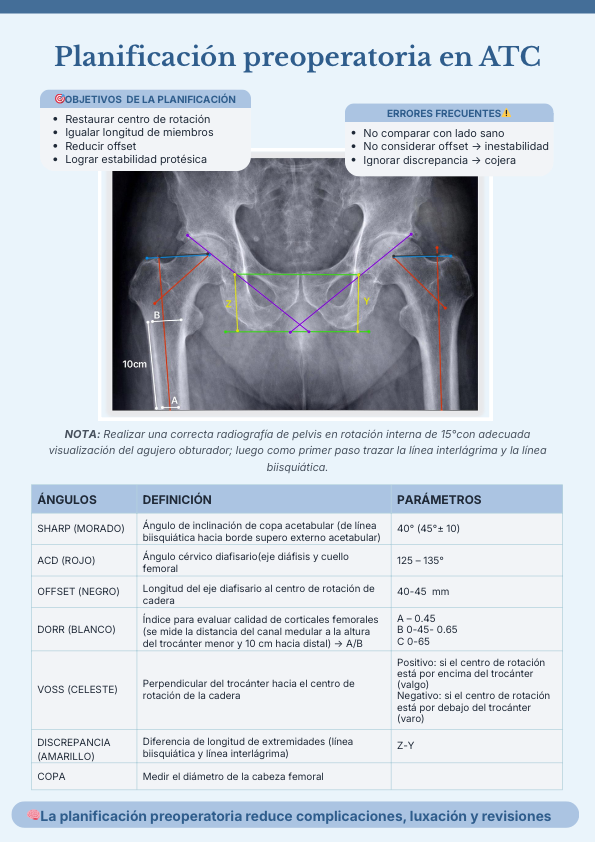 Planificación Preoperatoria en Artroplastia Total de Cadera (ATC)