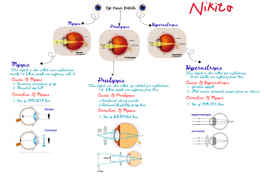 Eye Vision Defects Short Notes + Mind Maps